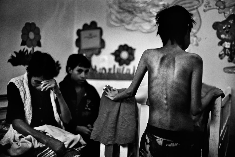 Guatemala: Gezeichnet durch chronische Unterernährung | ©JM Lopez/Freier Fotograf Guatemala: Gezeichnet durch chronische Unterernährung