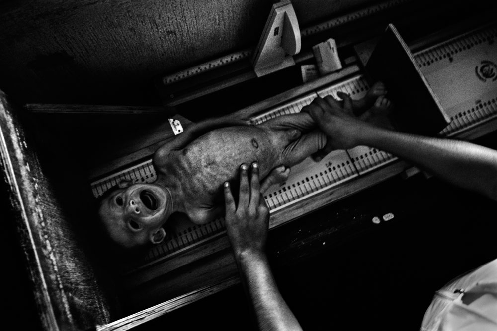 Guatemala: Gezeichnet durch chronische Unterernährung | ©JM Lopez/Freier Fotograf Guatemala: Gezeichnet durch chronische Unterernährung