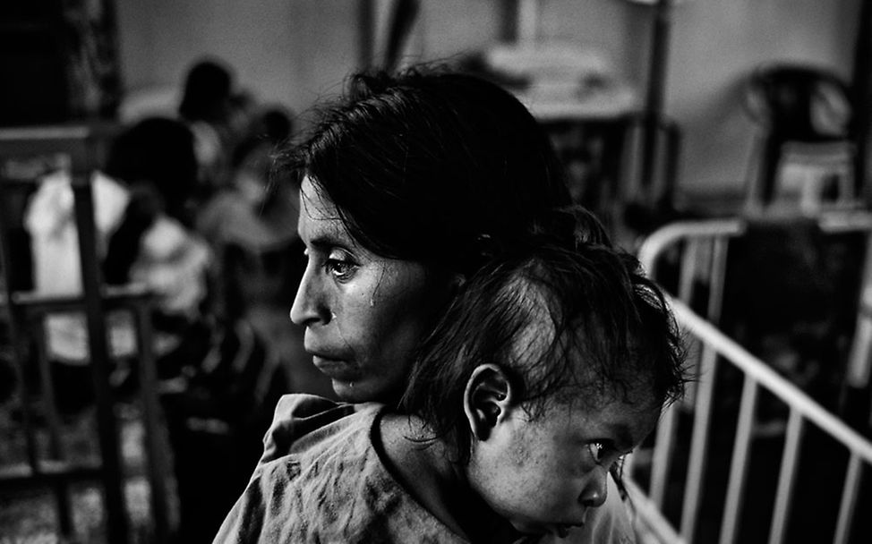 Guatemala: Marked by malnutrition