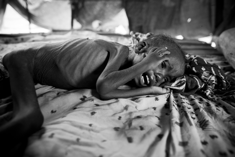 Somalia: Never ending war, hunger an death