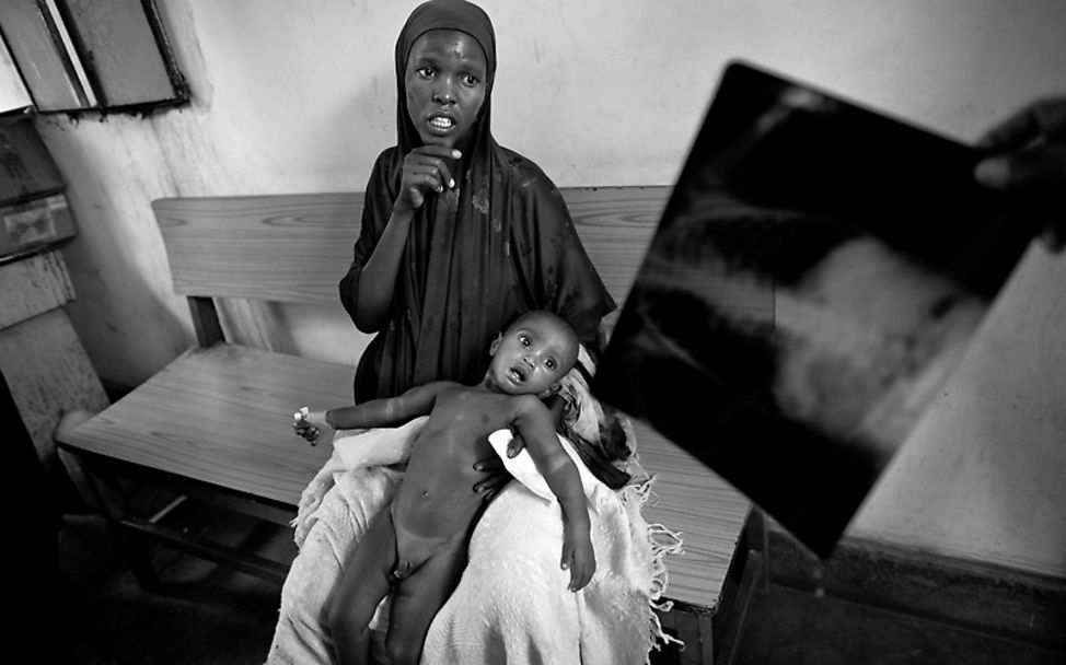 Somalia: Never ending war, hunger an death