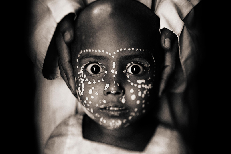 Bangladesh: Refugees from Myanmar | © Javier Arcenillas/Freelance Photographer Bangladesh: Refugees from Myanmar