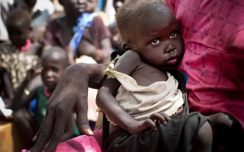 Eine Mutter im Südsudan hält ihr schwer mangelernährtes Kind im Arm | © UNICEF/UN016614/Holt Südsudan Hungersnot: Eine Mutter im Südsudan hält ihr schwer mangelernährtes Kind