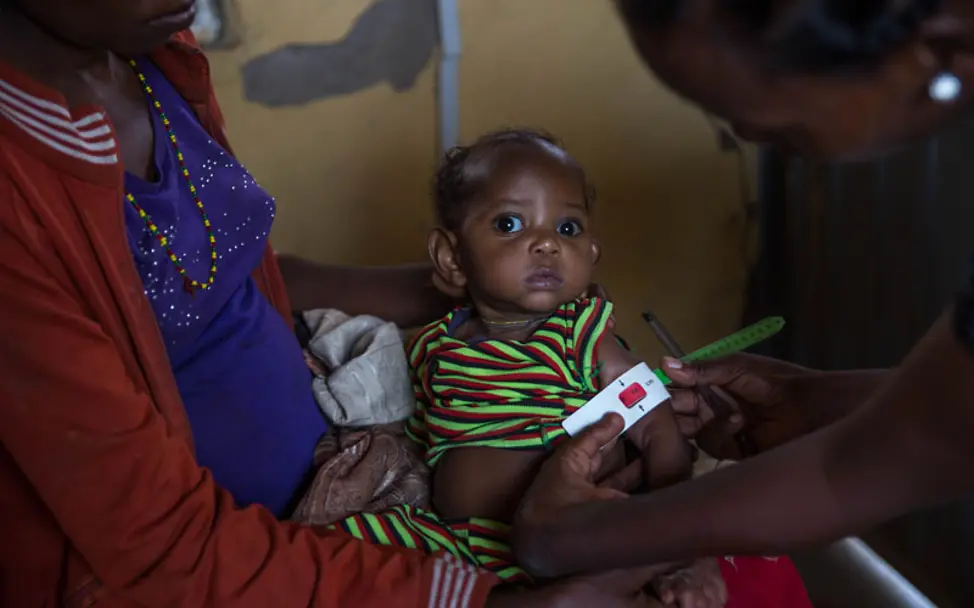 El Niño Äthiopien: Mit dem Maßband gegen Unterernährung | © UNICEF/Ayene El Niño Äthiopien: Das Maßband diagnostiziert Mangelernährung.
