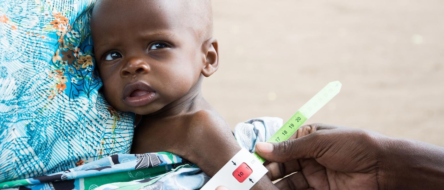 Einsatzbereiche: UNICEF hilft mangelernährten Kindern