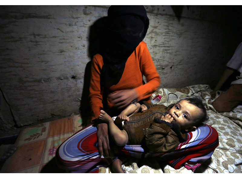 Yemen: Those who can’t forget | © Yahya Arhab (epa) Yemen: Those who can’t forget | © Yahya Arhab (epa)