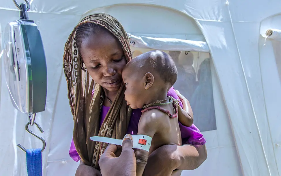 UNICEF hilft in Borno, Nigeria gegen Mangelernährung. | © UNICEF/Esiebo Der gerade einmal elf Monate alte Sohn von Jide ist schwer mangelernährt. In einem UNICEF Zentrum wird der Kleine versorgt.