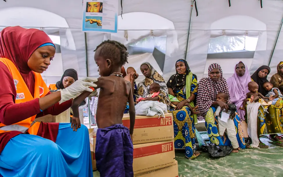 Ein Kleinkind wird in Nigeria auf Mangelernährung untersucht | © UNICEF/Esiebo Hungersnot: Eine UNICEF-Helferin untersucht ein Kleinkind auf Mangelernährung