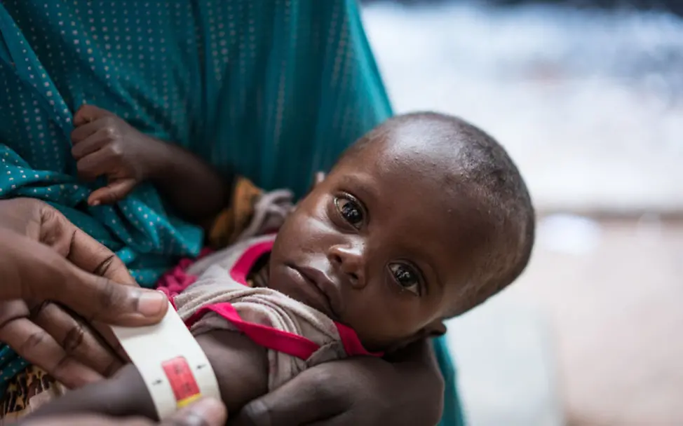 Das Maßband zeigt an: Dieses Mädchen ist schwer unterernährt | © UNICEF/Mackenzie Knowles-Coursin Somalia: Weil das Maßband Rot anzeigt ist klar, dass das Mädchen schwer unterernährt ist