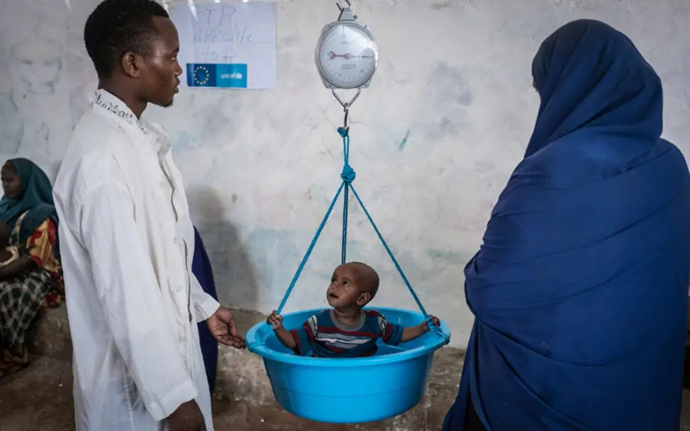 Von UNICEF ausgebildete Mitarbeiter wiegen ein Kind | © UNICEF/Knowles-Coursin Somalia: Ein Kind wird gewogen und von Ernährungsexperten behandelt