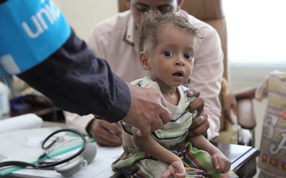 Im Jemen wird ein kleiner Junge von UNICEF-Helfern versorgt | © UNICEF/Al-Zikri Jemen: Ein kleiner Junge wird von Helfern versorgt
