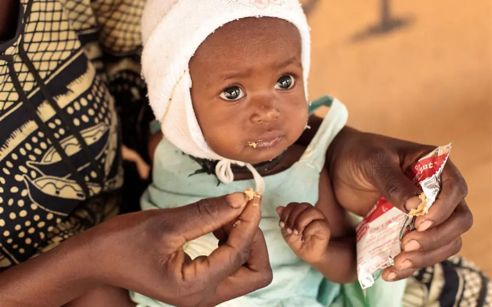 Samaatou wird mit Erdnusspaste gefüttert, damit sie schnell wieder gesund wird | © UNICEF/Asselin Samaatou ist schwer mangelernährt und wird mit Zusatz-Nahrung gefüttert