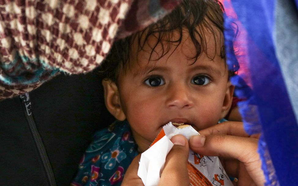 Spezielle Erdnusspaste hilft mangelernährten Kindern.   