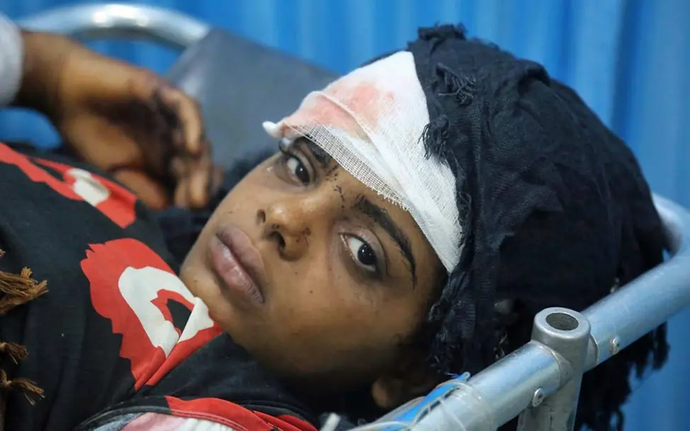 Täglich werden Kinder auf der Flucht verletzt und getötet. | © UNICEF/Ayyashi Jemen: Täglich werden Kinder auf der Flucht verletzt und getötet.