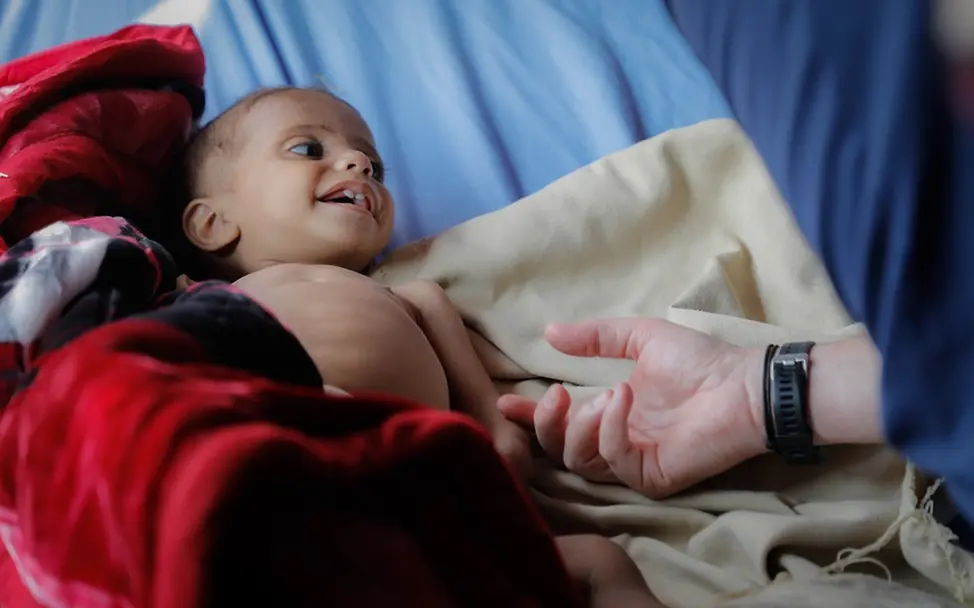 Über 1,8 Millionen Kinder leiden im Jemen an akuter Mangelernährung. | © UNICEF/Moohialdin Ein Kind, das unter Mangelernährung leider in einem Krankenhaus in Sana'a/Jemen.