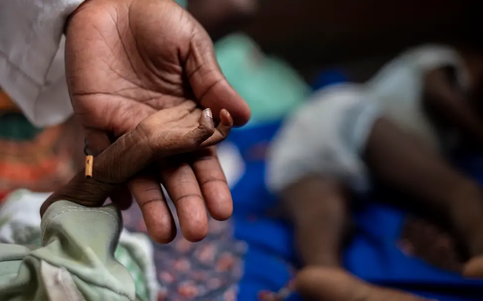 Das Ausmaß von Hunger in der Zentralafrikanischen Republik ist extrem alarmierend. | UNICEF/Gilbertson VII Photo Dünnes Kinderärmchen in der Hand eines Erwachsenen.