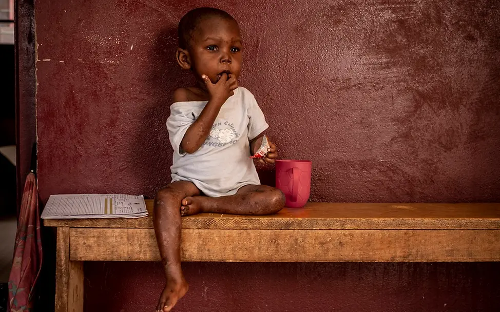UNICEF stellt fast alle therapeutische Nahrung im Land zur Verfügung, um mangelernährte Kinder zu behandeln. | © UNICEF/Gilbertson VII Photo UN0239465_ZAR Spezialnahrung
