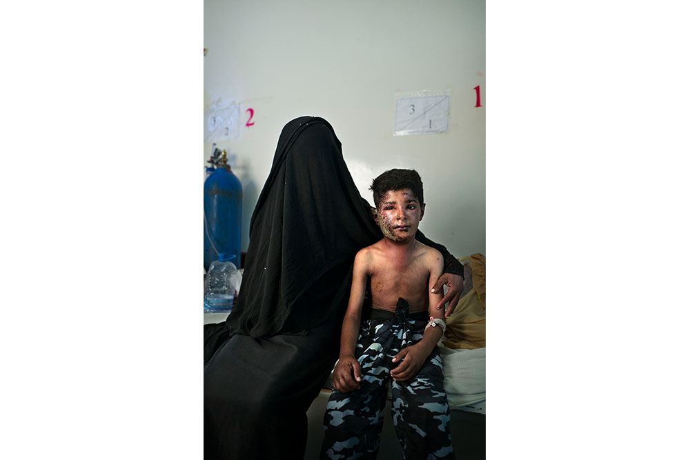 Yemen: Between life and death 