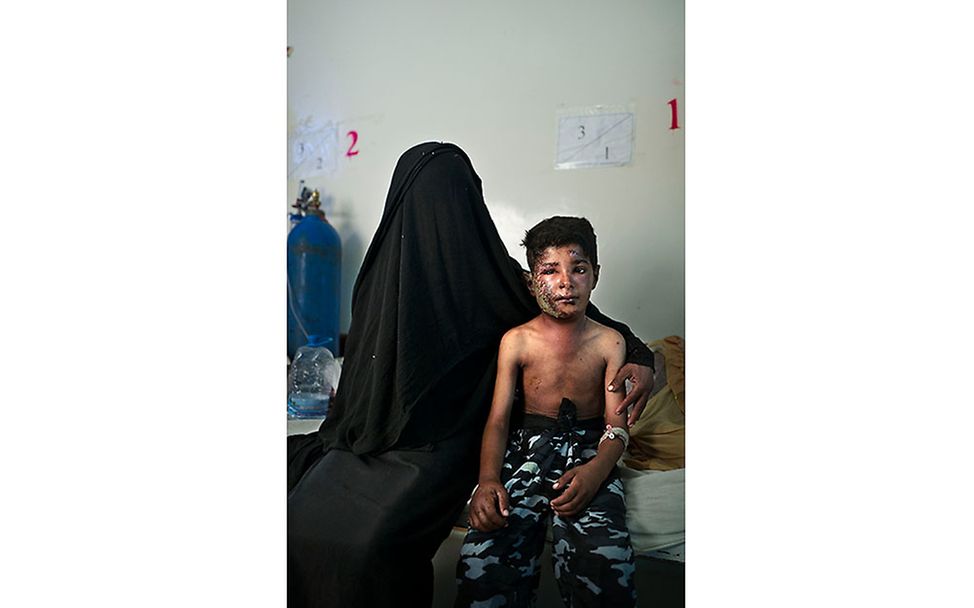 Yemen: Between life and death 