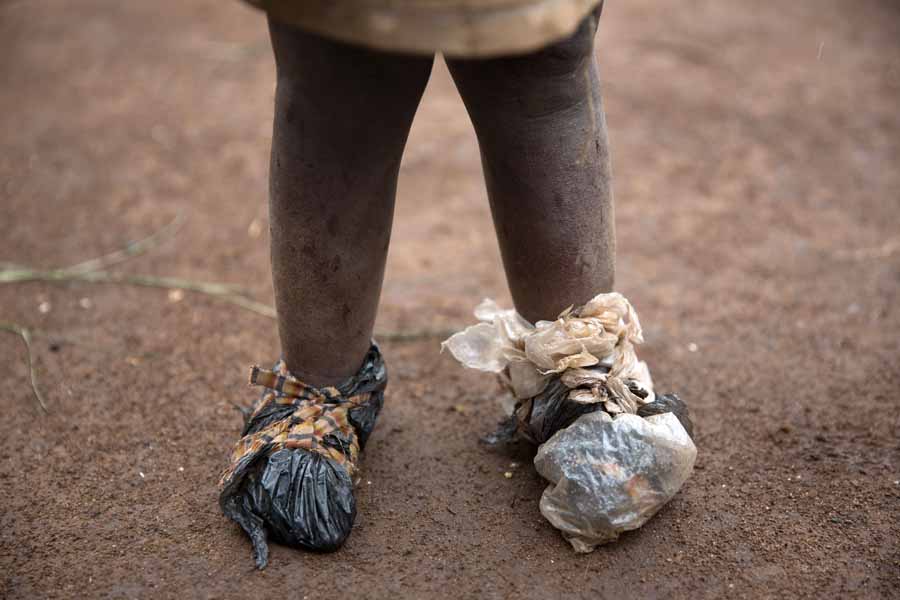 Ein Flüchtlingskind trägt provisorische Schuhe aus Plastiktüten in der Demokratische Republik Kongo.