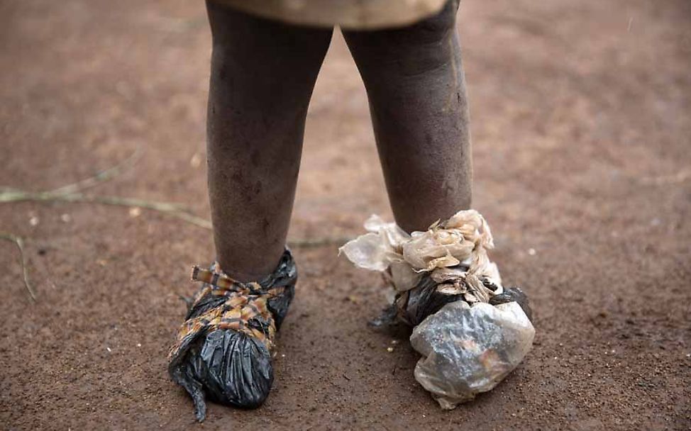 Ein Flüchtlingskind trägt provisorische Schuhe aus Plastiktüten in der Demokratische Republik Kongo.