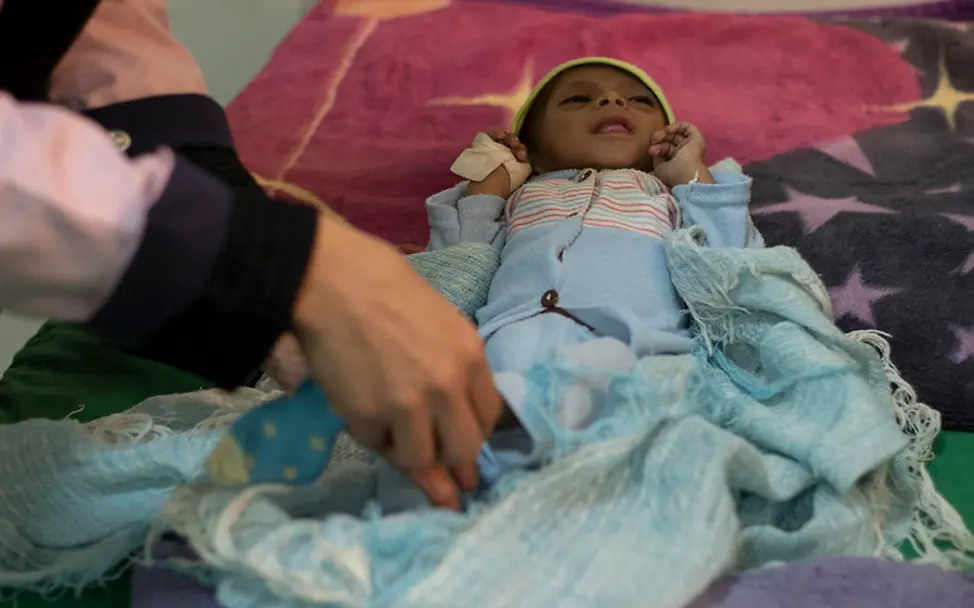 UNICEF setzt sich für eine sichere Geburtshilfe ein. | © UNICEF/Baholis Jemen: Ein mangelernährtes Baby wird auf der Station für therapeutische Ernährung behandelt.