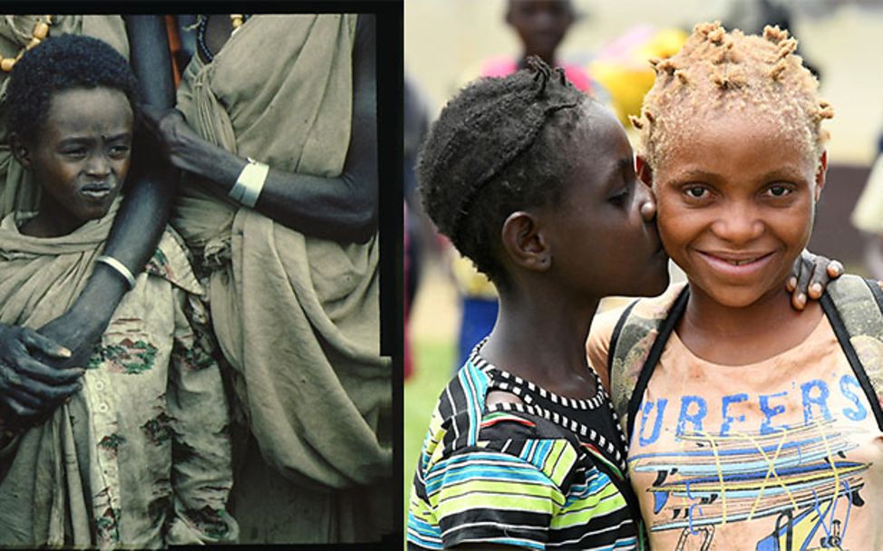 Collage: Ein Kind sucht Schutz bei seiner Mutter und ein Albinomädchen mit ihren Freundinnen.