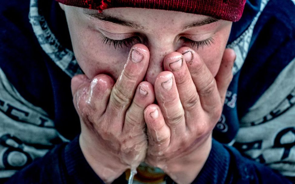 Der 14-jährige Aleksey hat durch eine Granate drei Finger verloren. 