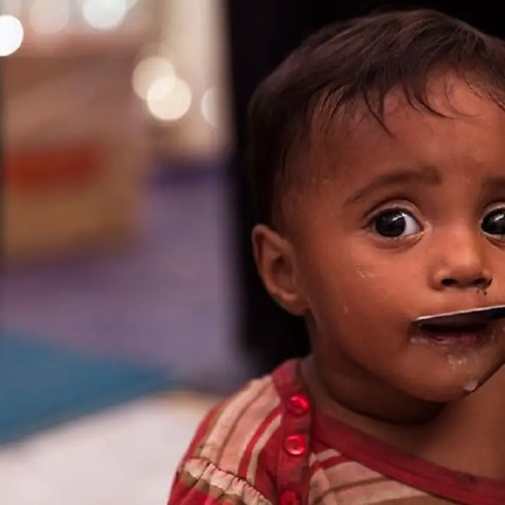 There are still many children suffering from malnutrition worldwide © UNICEF/UN0151415/Brown There are still many children suffering from malnutrition worldwide © UNICEF/UN0151415/Brown