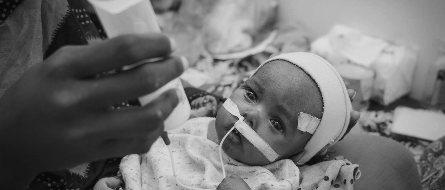 Jemen: Die schwer mangelernährte Saleh bei der Behandlung im Krankenhaus in Aden