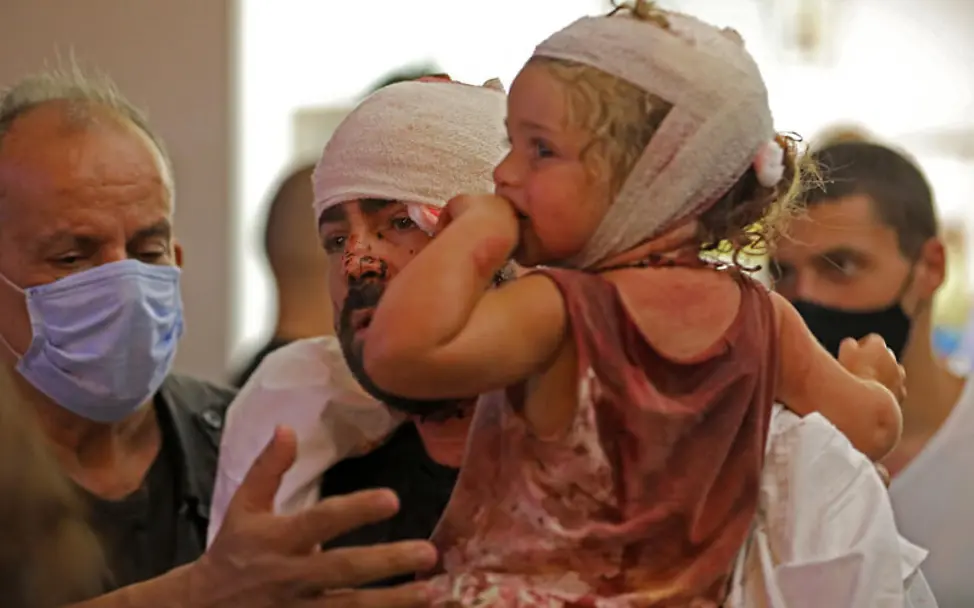 Explosion in Beirut im Libanon: Ein verletztes Kind ein einem Krankenhaus
