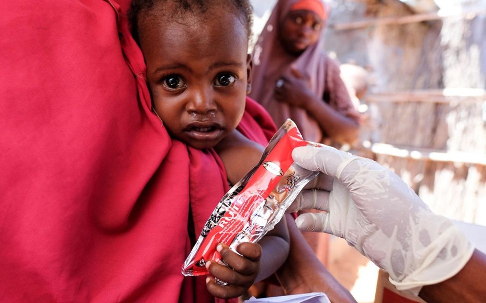 Somalia spenden gegen Hunger: Ein Baby bekommt Erdnusspaste.