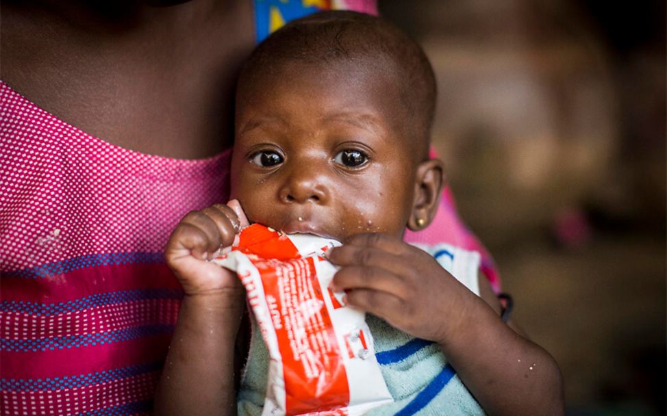 Mali: Die mangelernährte Aissata isst Erdnusspaste