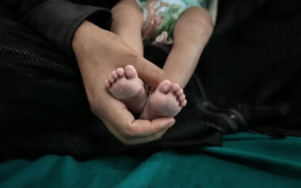 Jemen: Die 4 Monate alte Ethar Omar Abdo Alshahar im Krankenhaus von Sana'a leidet an Mangelernährung | © UNICEF/UNI312470/Alghabri Jemen: Die 4 Monate alte Ethar Omar Abdo Alshahar im Krankenhaus von Sana'a leidet an Mangelernährung
