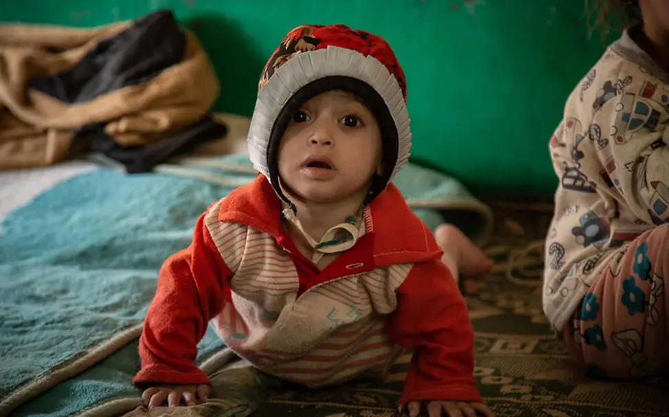 UNICEF: Ein Mädchen im Jemen krabbelt über den Boden. | © UNICEF UNICEF: Ein Mädchen im Jemen krabbelt über den Boden.