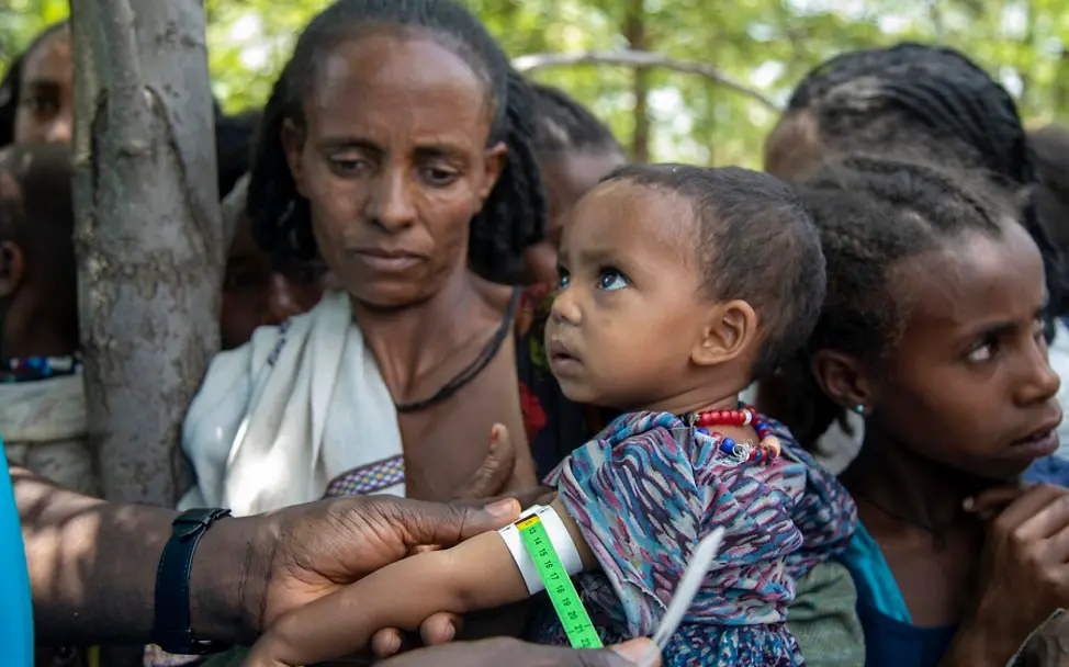 Äthiopien: Zahl mangelernährter Kinder steigt | © UNICEF/Nesbitt Ein Gesundheitshelfer misst den Armumfang des kleinen Jungen in Äthiopien.