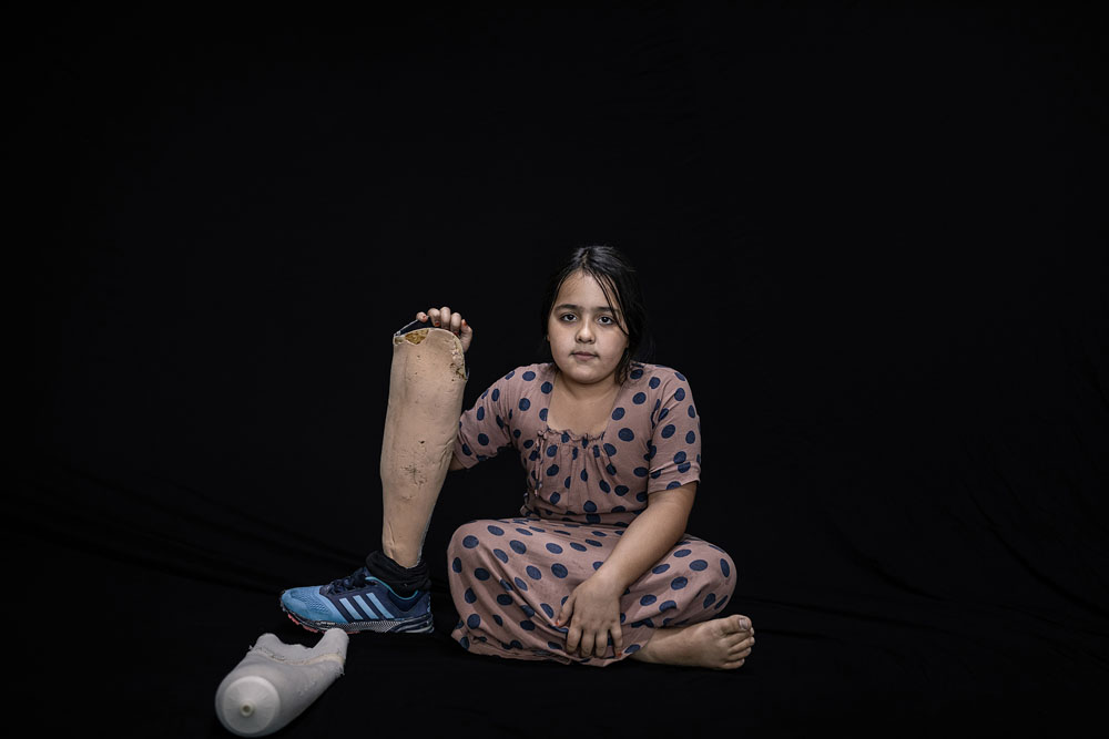 Irak: Leben mit der Verletzung | © Younes Mohammad, Irak (Agentur Middle East Images)) Irak: Leben mit der Verletzung