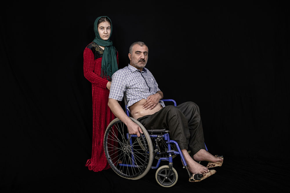 Irak: Leben mit der Verletzung | © Younes Mohammad, Irak (Agentur Middle East Images) Irak: Leben mit der Verletzung