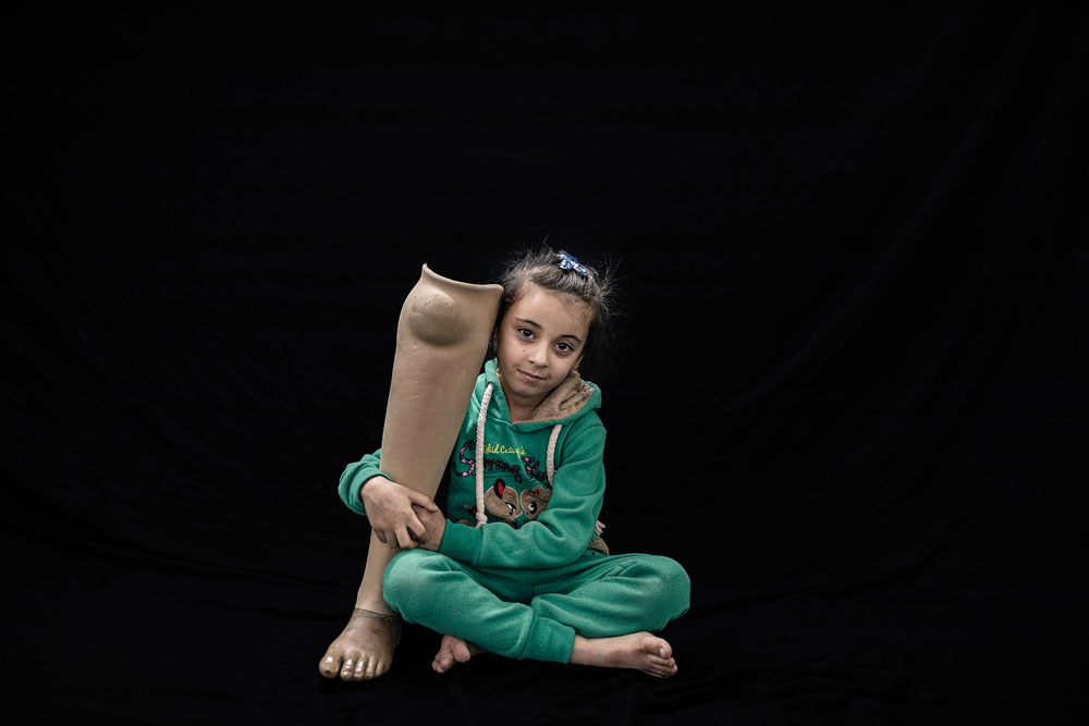 Irak: Leben mit der Verletzung | © Younes Mohammad, Irak (Agentur Middle East Images)) Irak: Leben mit der Verletzung