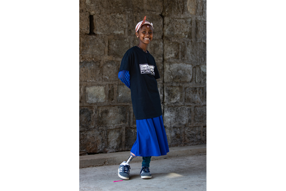 Matilde Simas, USA, for Limb Kind Foundation Philippines, Ethiopia, Haiti: Bringing mobility to children with limb loss