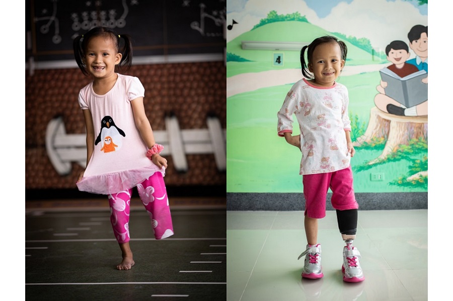 Philippines, Ethiopia, Haiti: Bringing mobility to children with limb loss | © Matilde Simas, USA, for Limb Kind Foundation Philippines, Ethiopia, Haiti: Bringing mobility to children with limb loss