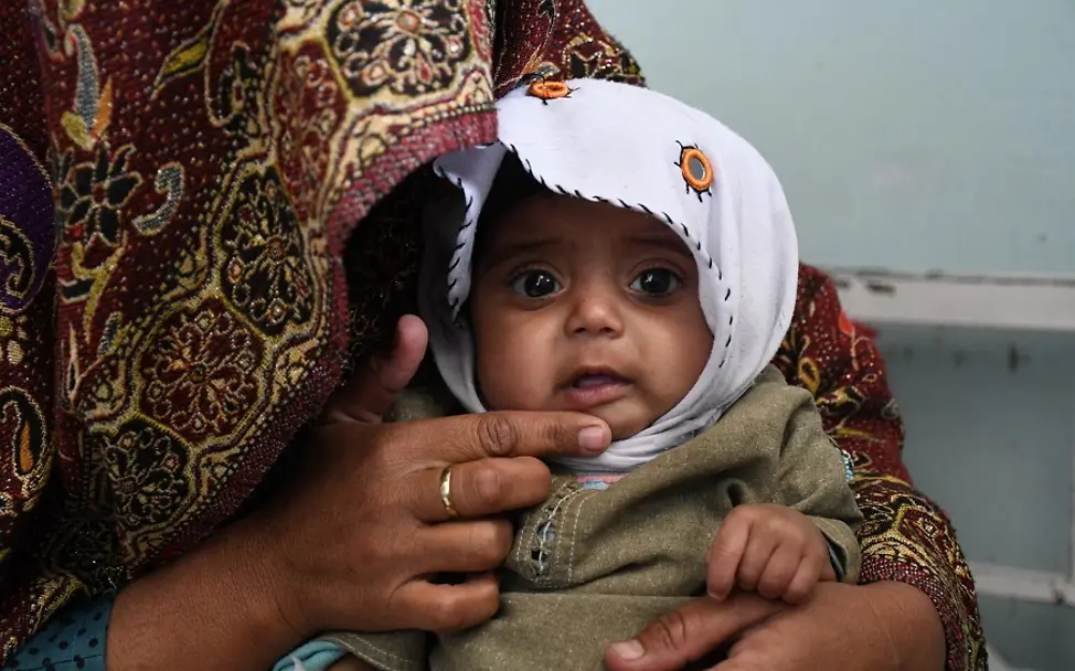 De Kinder in Afghanistan brauchen weiter dringend Hilfe. | © UNICEF/Karimi Afghanistan: Ein 8-Monate alter Junge wird auf Mangelernährung untersucht.