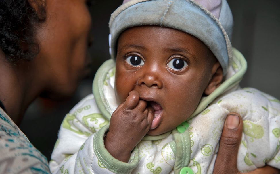 Hungerkrise: Ein unterernährtes Baby in Äthiopien.