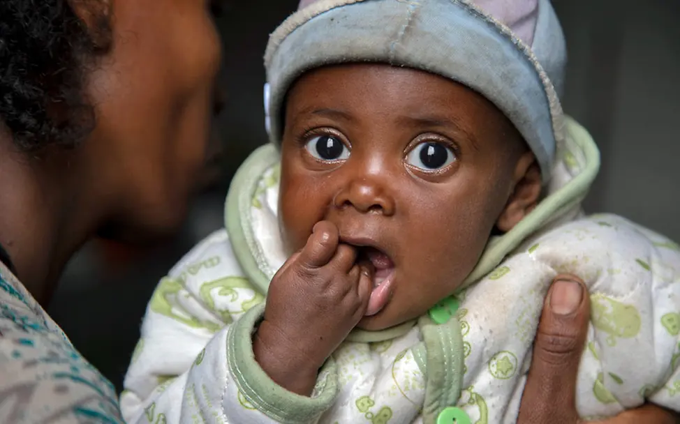Hunger in der Welt: Ein Baby in Äthiopien. | © UNICEF/Nesbitt Hungerkrise: Ein unterernährtes Baby in Äthiopien.
