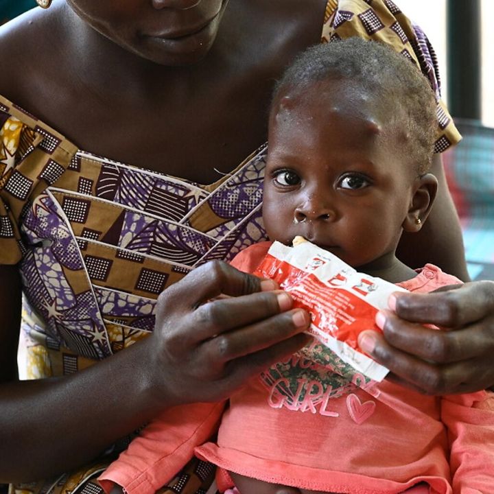 Schutz vor Hungersnot: Ein Baby erhält therapeutische Erdnusspaste zur Behandlung von Mangelernährung.