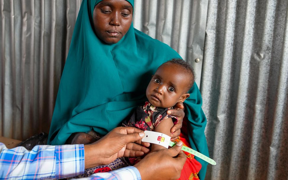 UNICEF: Ein Junge wird auf Mangelernährung untersucht.