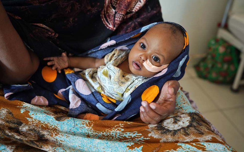 Drohende Hungersnot Somalia: Hunderttausende Kinder sind schwer mangelernährt und brauchen humanitäre Hilfe. 