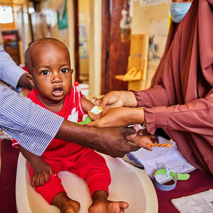 Kenia Hunger: Ein Baby wird auf Mangelernährung untersucht. In Kenia herrscht eine Hungerkrise.