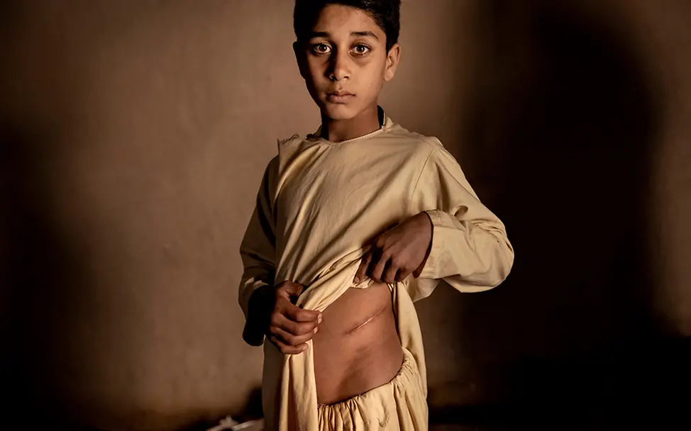 Afghanistan: Der hohe Preis für einen Frieden, der keiner ist | © Mads Nissen, Dänemark, Politiken, Agentur laif Afghanistan: Der hohe Preis für einen Frieden, der keiner ist