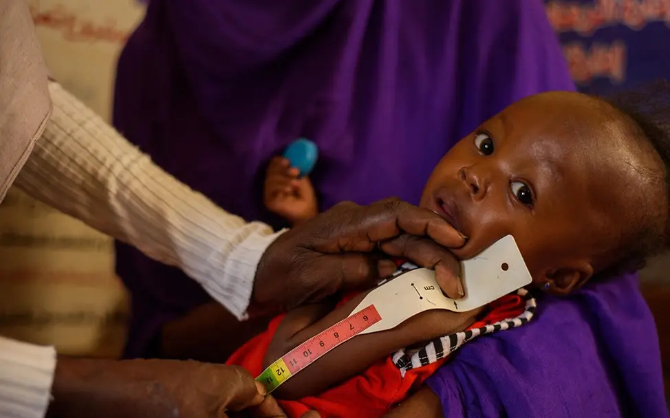 Der Hunger im Sudan ist allgegenwärtig | UNICEF/Mohamdeen Sudan: Erste UN-Mission seit April 2023 erreicht den Bundesstaat Khartoum, Sudan / Hunger ist allgegenwärtig